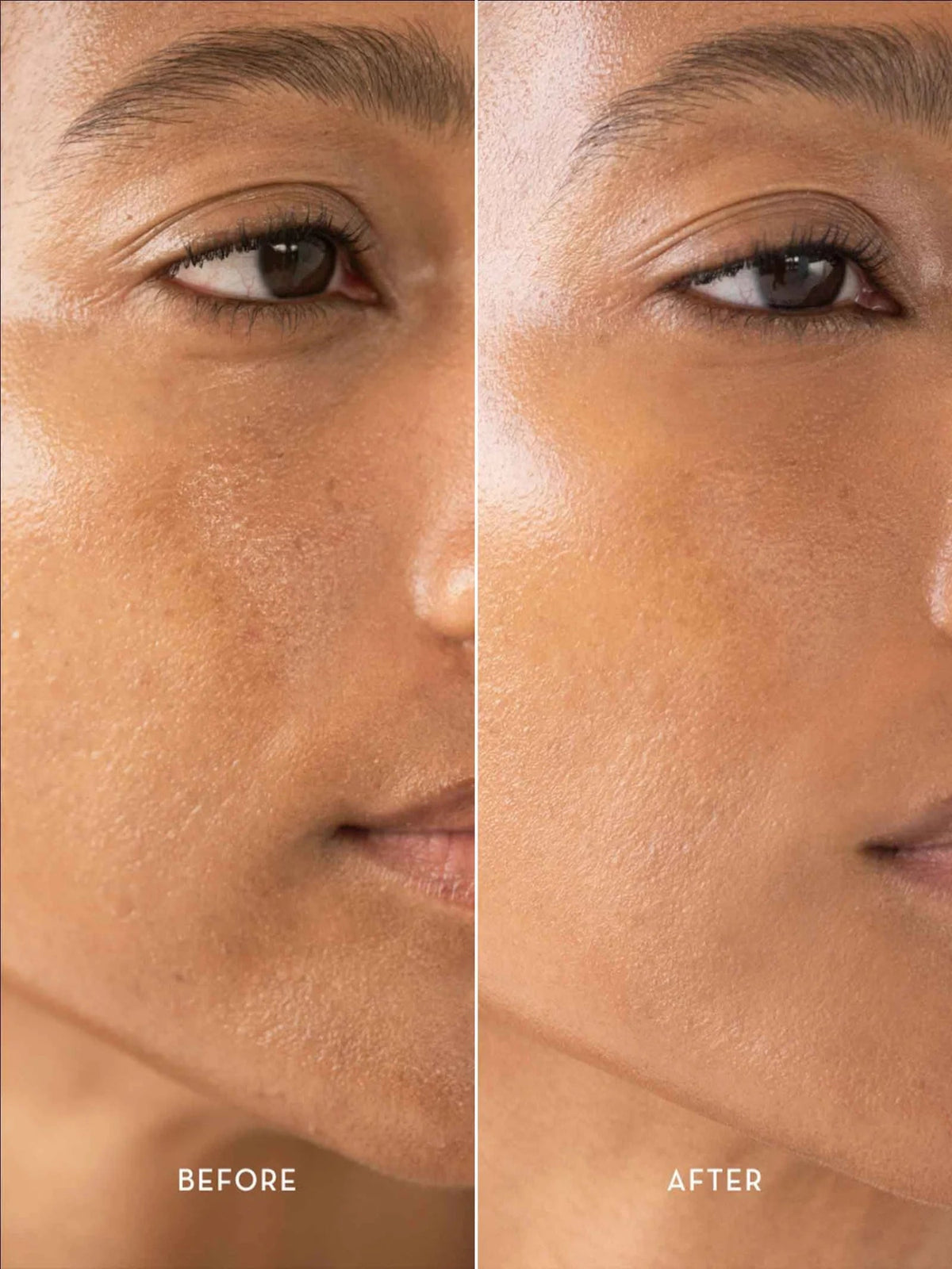 Furtuna Skin Triple Active Exfoliator 80 ml before and after skin results