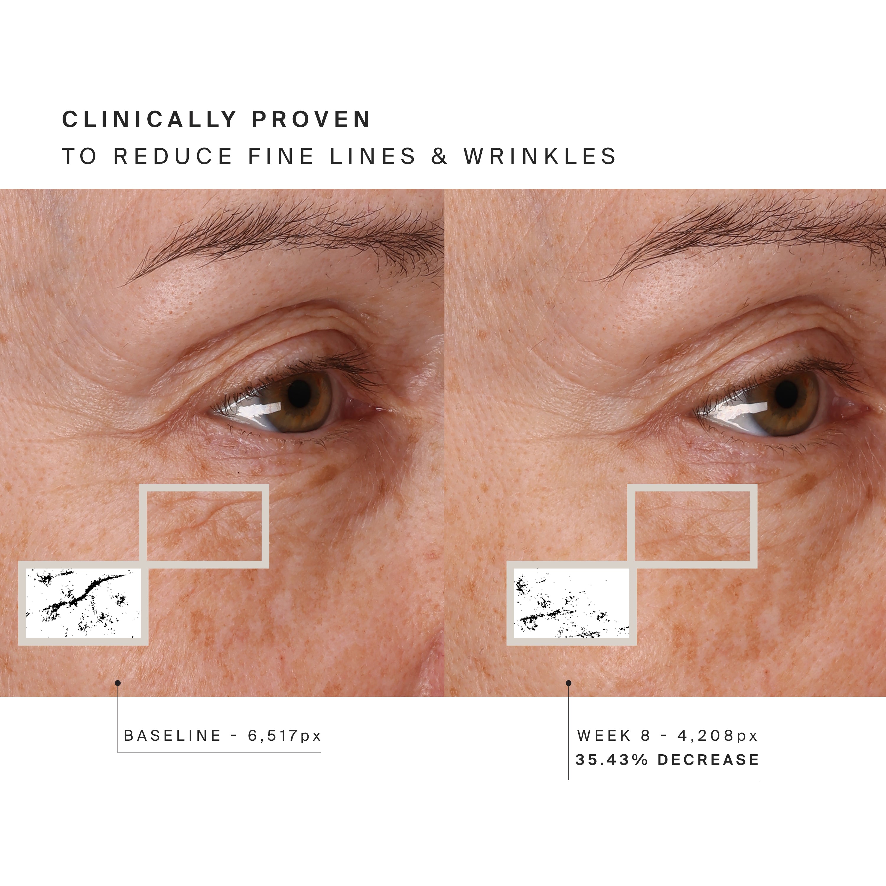 HIGHERDOSE Red Light Face Mask before and after showing reduced fine lines and wrinkles
