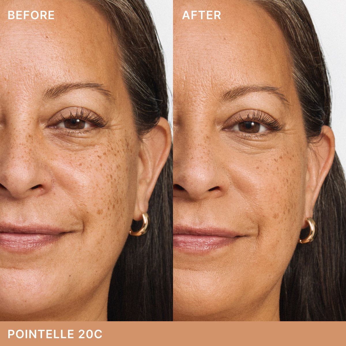 ILIA Beauty Skin Blur Concealer in Pointelle 20C, before-and-after comparison showing a more even-looking complexion with a smooth, natural finish on medium skin with cool undertones.